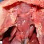 Bilateral diaphragmatic hernia in malformative syndrome
