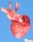 Left ventricle hypoplasia with aortic arch hypoplasia (Fetus)