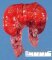 Intestinal infarction by volvulus