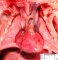 Left ventricle hypoplasia with aortic arch hypoplasia (Fetus)