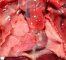Dextrocardia with pulmonary artery hypoplasia in heterotaxy with (...)